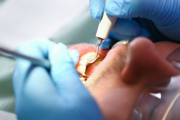 Best Pediatric Emergency Dentist in Bridge City, TX