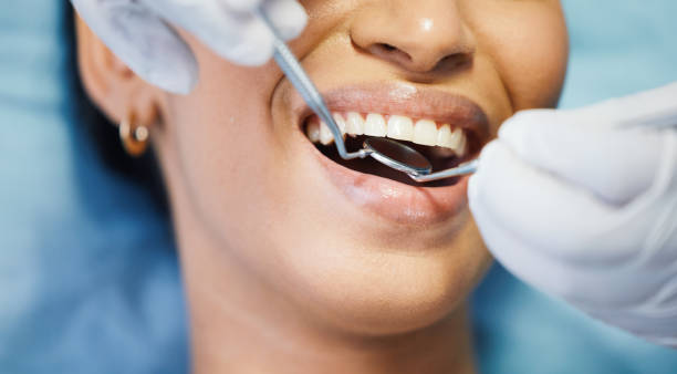 Best After-Hours Emergency Dentist in Bridge City, TX