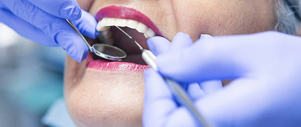 Best Emergency Root Canal Treatment in Bridge City, TX